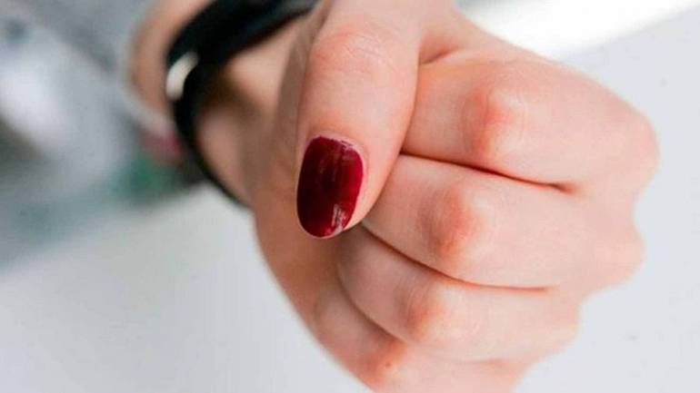 Бійка подруг на Вінниччині призвела до лікарняного ліжка