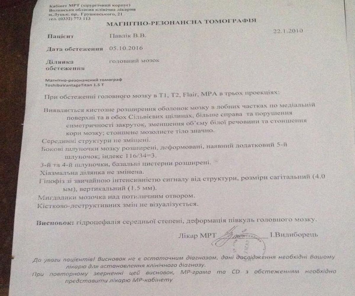 yuna volychanka poterpaye vid strashnoyi khvoroby 3