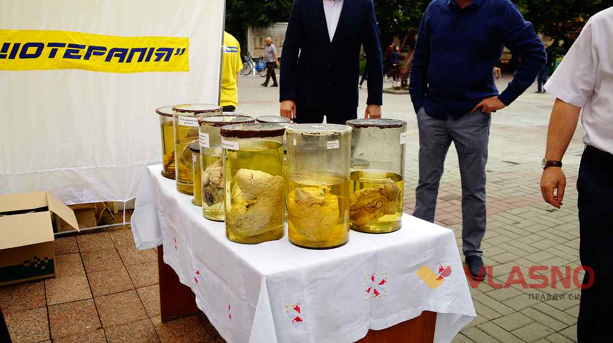 akcija-tutun-i-zdorovia-vinnitsia-10 1
