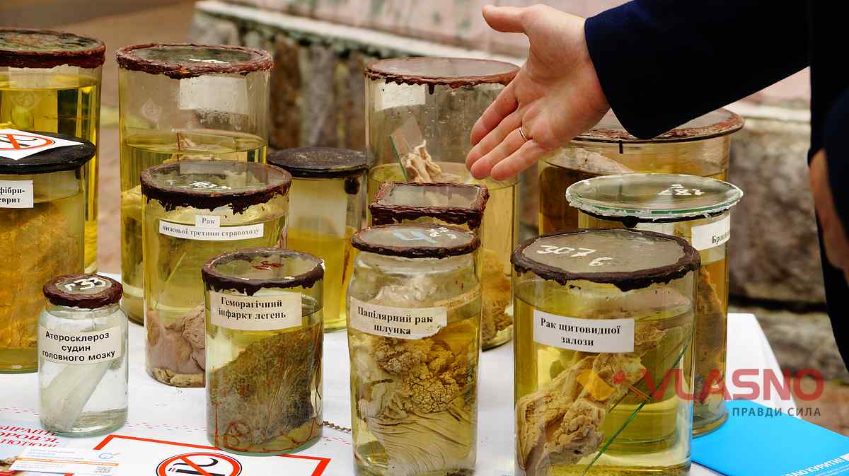 akcija-tutun-i-zdorovia-vinnitsia-25 1