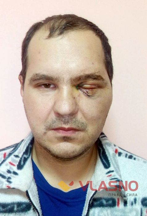 На Вінниччині п'яна жінка вдарила в око поліцейського: він осліп, суд відпустив підозрювану 