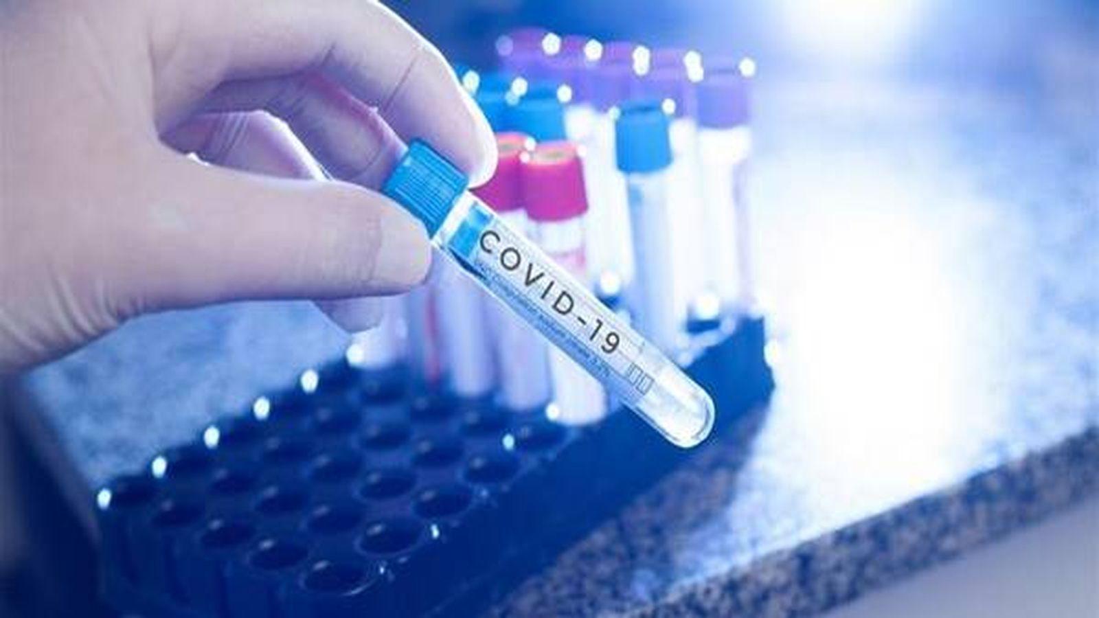 В Україні виявили 11 968 хворих на коронавірус за добу