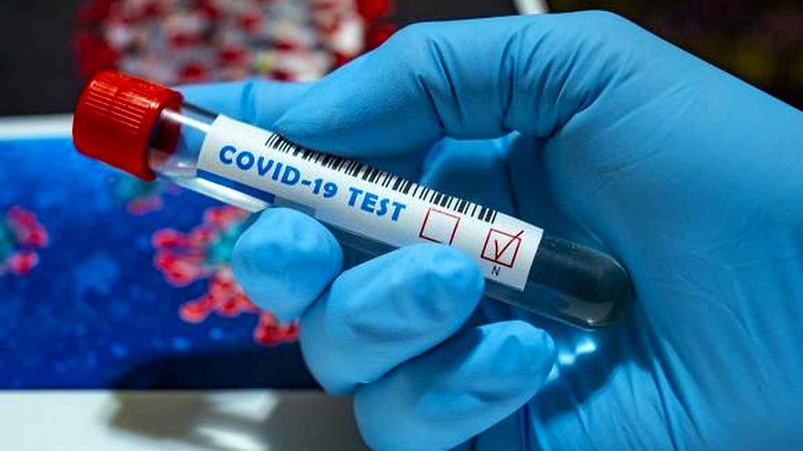 На Вінниччині за добу виявили 131 випадок захворювання на COVID-19