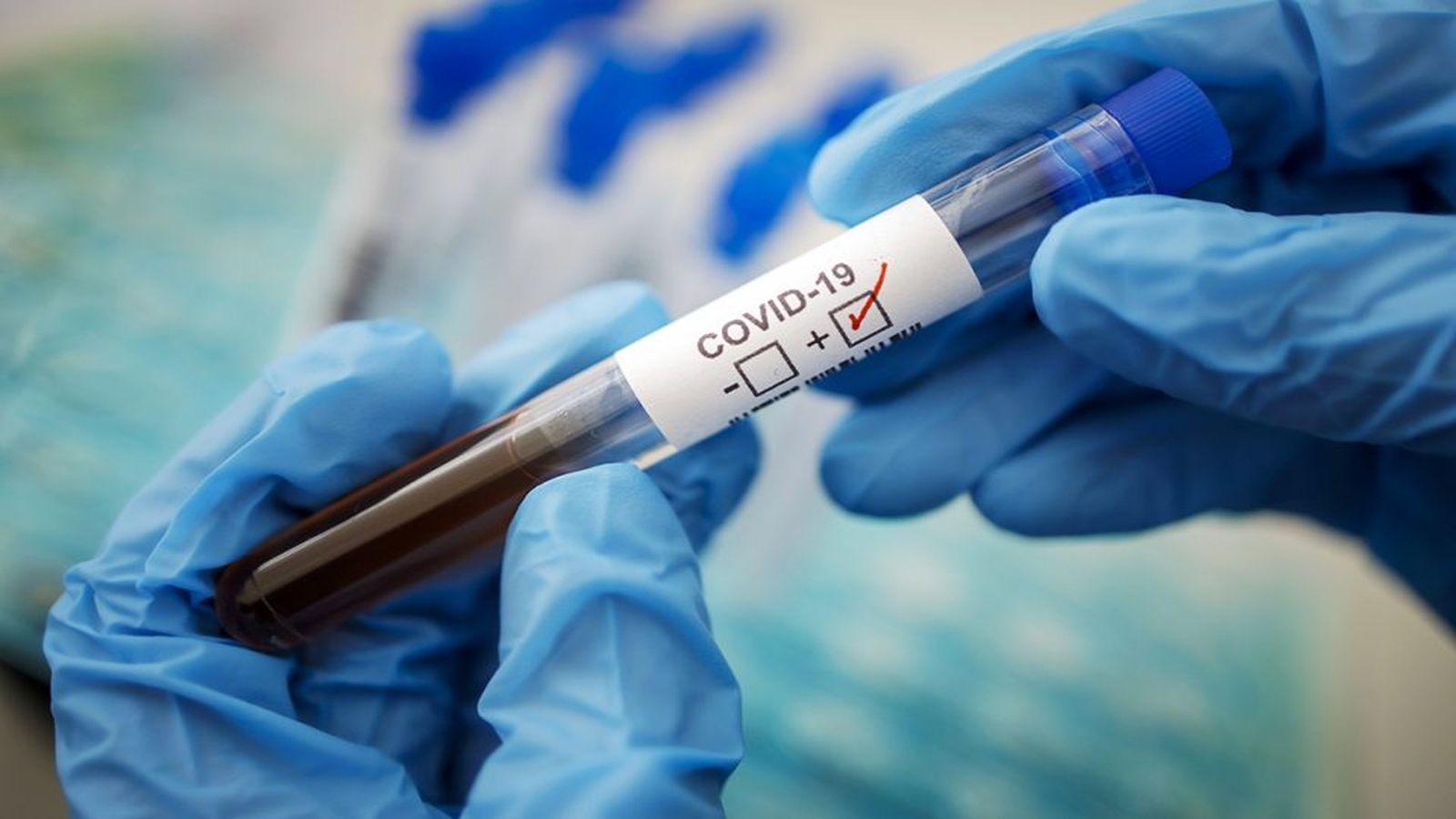 Мутація COVID-19 у диких тварин може викликати нову пандемію