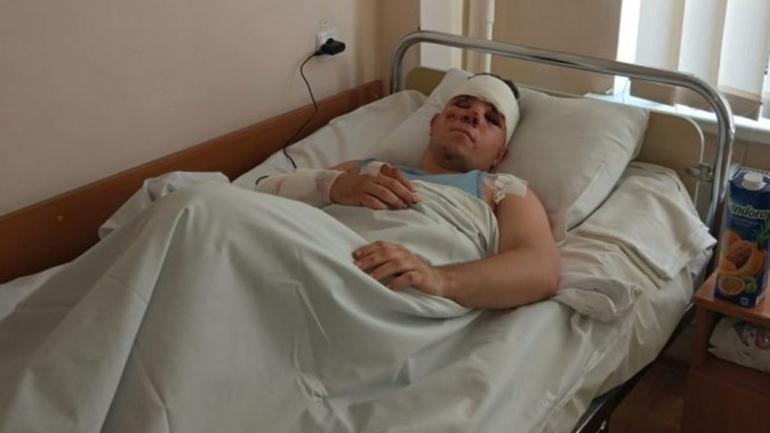 Стан курсанта, що вижив у катастрофі на Харківщині, &laquo;ближче до задовільного&raquo;